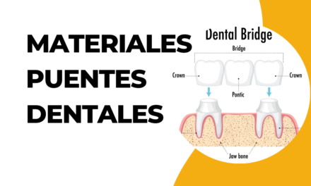 Prótesis dental fija: tipos materiales y cuidados