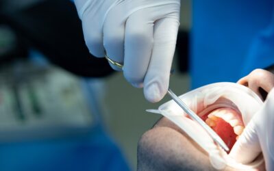 Indicaciones Postoperatorias a una Extracción Dental