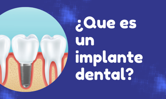 ¿Que es un Implante dental?